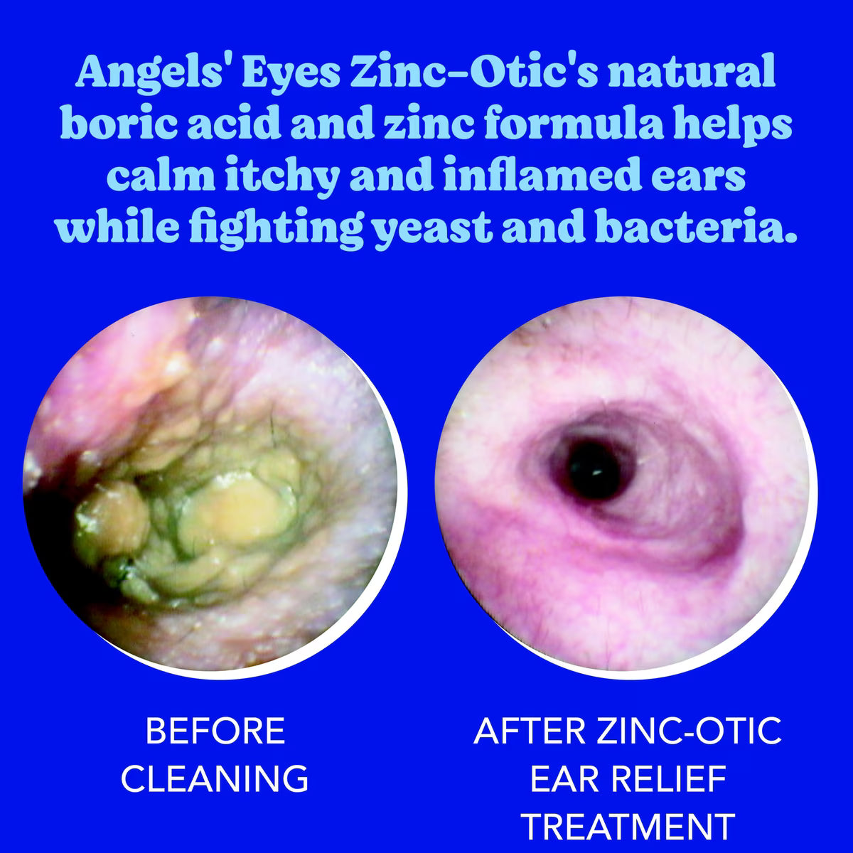 Angel's Eyes Zinc-Otic Ear Relief Treatment for Dogs & Cats, 1-oz
